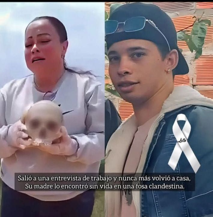 media 1