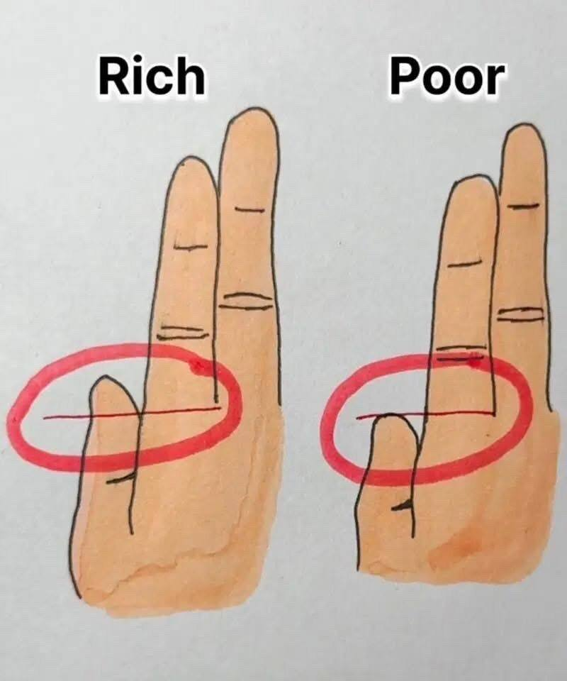 media 1