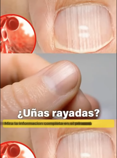 media 1